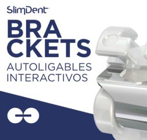 Brackets Interactivos Slimdent